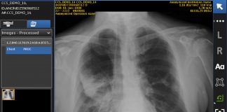 GE Healthcare wins first FDA clearance for A.I. powered X-ray system