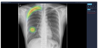 This South Korean Medical Imaging Startup Uses AI to Help Doctors Prioritize Patients with COVID-19 Symptoms
