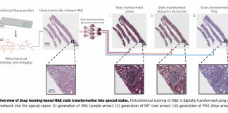 UCLA Researchers Propose A Deep Learning-Based AI Framework To Re-Stain Images Of Tissue Biopsy