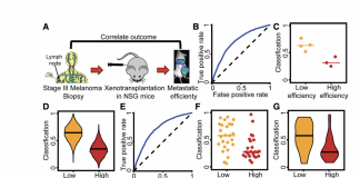 A New AI Research Method Predicts Metastatic Risk in Skin Cancers Using A Generative Neural Network In Combination With Supervised Machine Learning