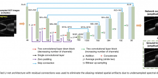 UCLA and University of Houston (UH) Researchers Propose A Deep Learning-Trained Neural Network-Based Image Reconstruction Framework to Rapidly Reconstruct OCT Images Using Undersampled Spectral Data