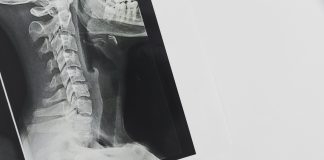 Stanford AIMI Releases Its Free Open-Source Repository Of Medical Datasets For Artificial Intelligence (AI) Research