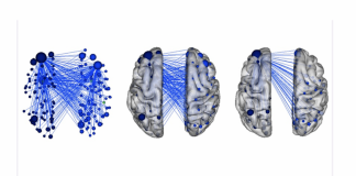 Yale Researchers Use Machine Learning To Identify Brain Networks Predictive Of Aggression In Children