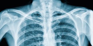 Meet ‘ChestLink’, The First Autonomous AI Medical Imaging Application by ‘Oxipit’ That Received CE Mark Approval in the EU