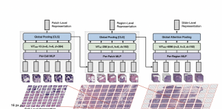 Harvard Researchers Introduce A Novel ViT Architecture Called Hierarchical Image Pyramid Transformer (HIPT) That Can Scale Vision Transformers To Gigapixel Images Via Hierarchical Self-Supervised Learning