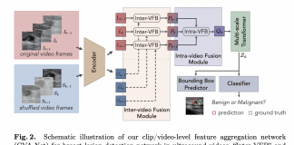 Researchers Develop a New Dataset and Baseline Model for Breast Lesion Detection in Ultrasound Videos