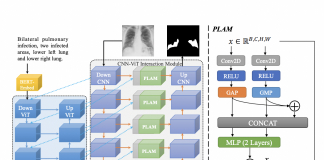 Researchers From China Propose ‘LViT’, A Language-Vision Model To Leverage Text Medical Reports For Improved Segmentation